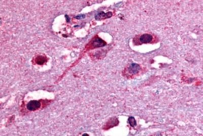 OPRD1 Antibody in Immunohistochemistry (Paraffin) (IHC (P))