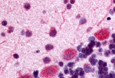 OPRK1 Antibody in Immunohistochemistry (Paraffin) (IHC (P))