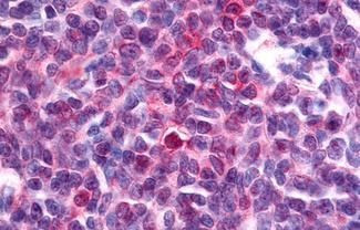 NOR-1 Antibody in Immunohistochemistry (Paraffin) (IHC (P))