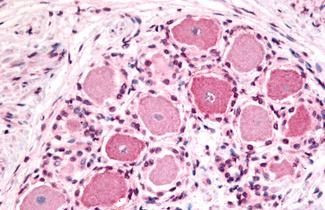 HTR1D Antibody in Immunohistochemistry (Paraffin) (IHC (P))