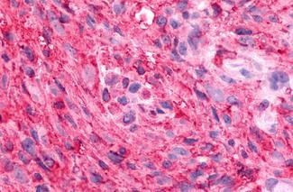 GPR88 Antibody in Immunohistochemistry (Paraffin) (IHC (P))