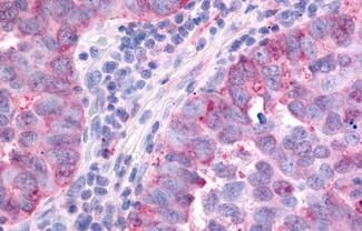 PAK6 Antibody in Immunohistochemistry (Paraffin) (IHC (P))