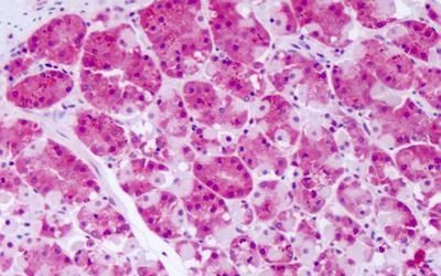 PRKD2 Antibody in Immunohistochemistry (Paraffin) (IHC (P))