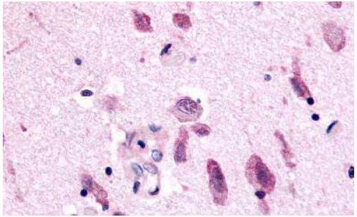 NEK7 Antibody in Immunohistochemistry (Paraffin) (IHC (P))