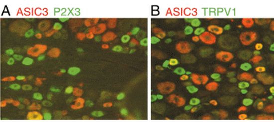 P2X3 Antibody in Immunohistochemistry (IHC)