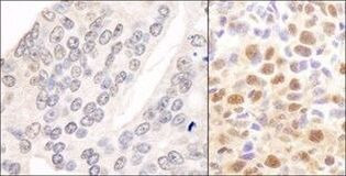 CSN2 Antibody in Immunohistochemistry (Paraffin) (IHC (P))
