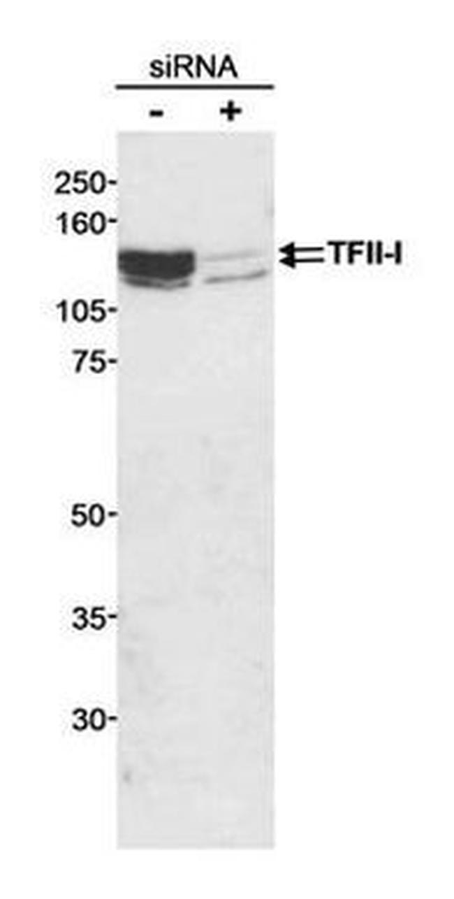 GTF2I Antibody in Western Blot (WB)