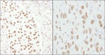 CA150 Antibody in Immunohistochemistry (Paraffin) (IHC (P))