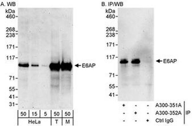 E6AP Antibody in Western Blot (WB)