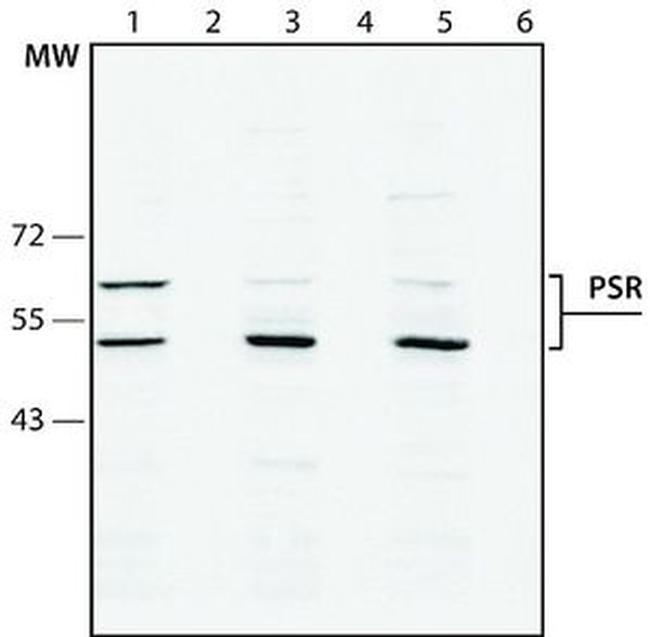JMJD6 Antibody in Western Blot (WB)