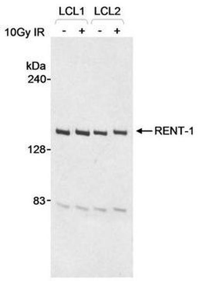 RENT1 Antibody in Western Blot (WB)