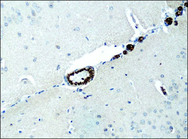 Destrin Antibody in Immunohistochemistry (Paraffin) (IHC (P))