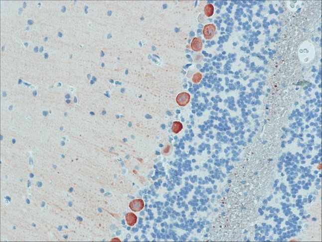 MYO5A Antibody in Immunohistochemistry (Paraffin) (IHC (P))