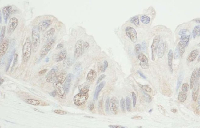 MDC1 Antibody in Immunohistochemistry (Paraffin) (IHC (P))