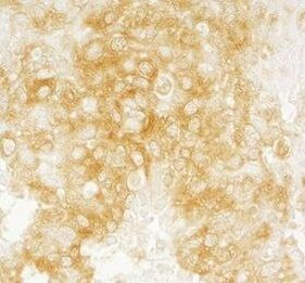 DIAPH1 Antibody in Immunohistochemistry (Paraffin) (IHC (P))