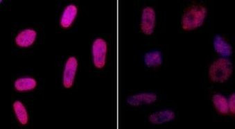 Phospho-Histone H2A.X (Ser139) Antibody in Immunocytochemistry (ICC/IF)