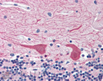 Syntaxin 2 Antibody in Immunohistochemistry (IHC)
