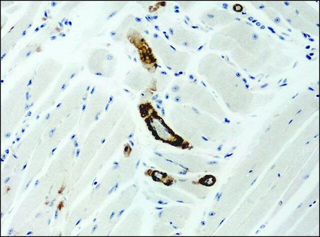 ASAP1 Antibody in Immunohistochemistry (Paraffin) (IHC (P))