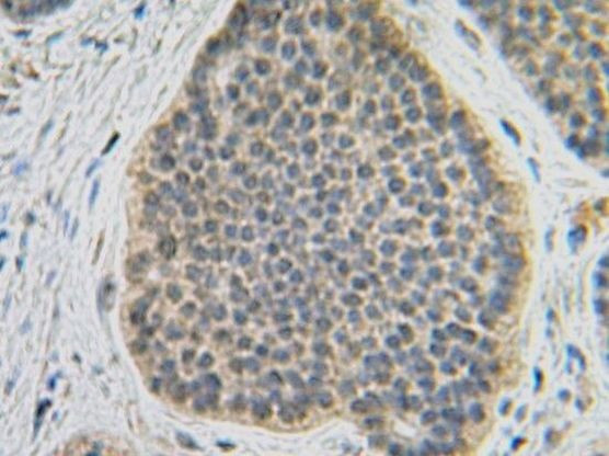 FGF10 Antibody in Immunohistochemistry (Paraffin) (IHC (P))