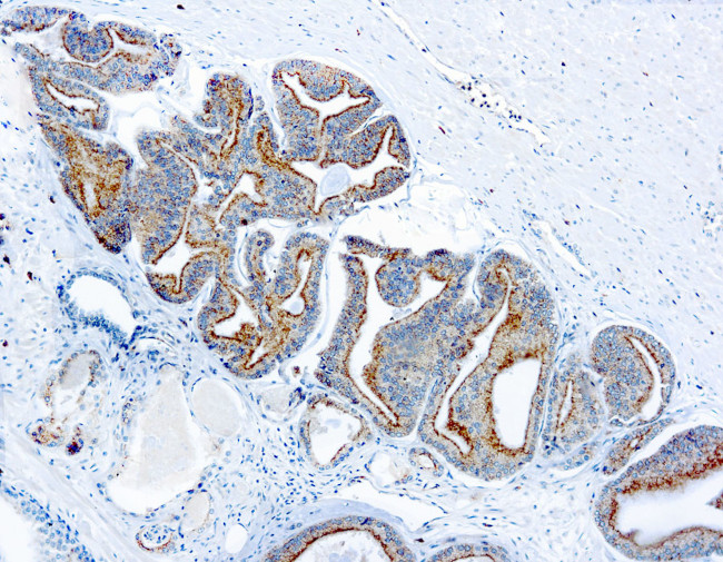 AMACR Antibody in Immunohistochemistry (Paraffin) (IHC (P))