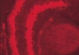 CSP alpha Antibody in Immunohistochemistry (IHC)