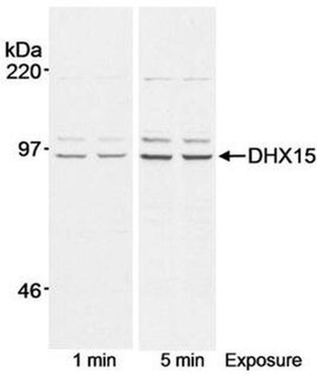 DHX15 Antibody in Western Blot (WB)