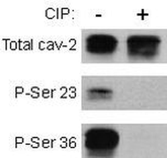Phospho-Caveolin 2 (Ser23) Antibody in Western Blot (WB)