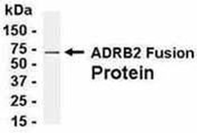 beta-2 Adrenergic Receptor Antibody in Western Blot (WB)