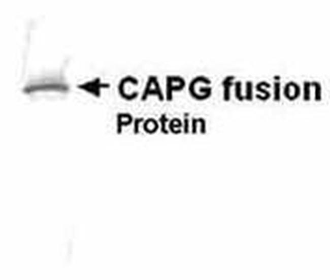NCAPG Antibody in Western Blot (WB)