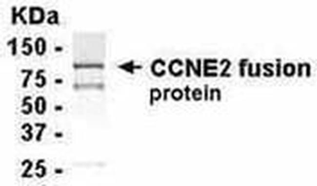 Cyclin E2 Antibody in Western Blot (WB)