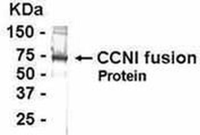 CYR61 Antibody in Western Blot (WB)