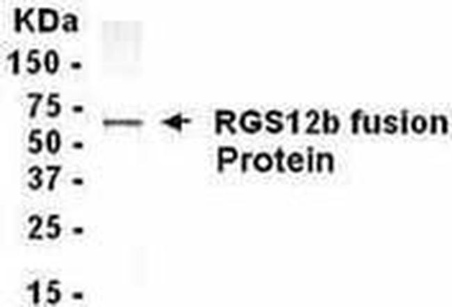 RGS12 Antibody in Western Blot (WB)