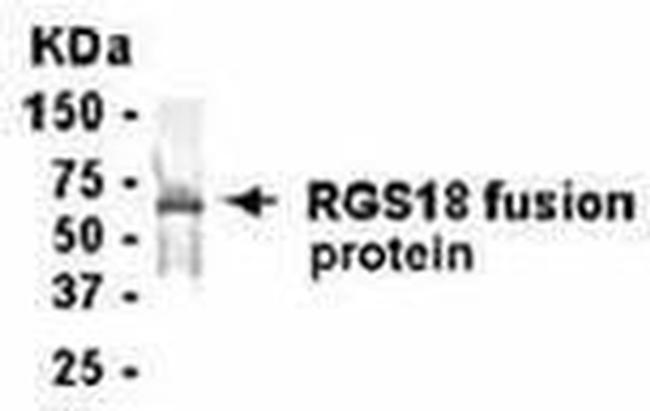 RGS18 Antibody in Western Blot (WB)