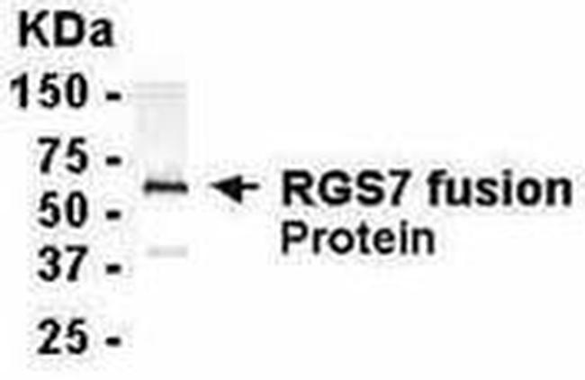 RGS7 Antibody in Western Blot (WB)