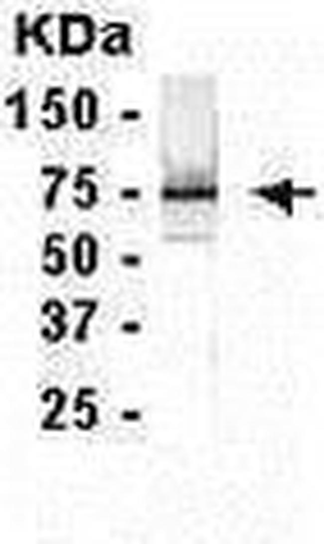 WHSC2 Antibody in Western Blot (WB)