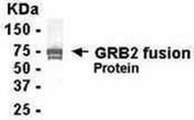 GRB2 Antibody in Western Blot (WB)