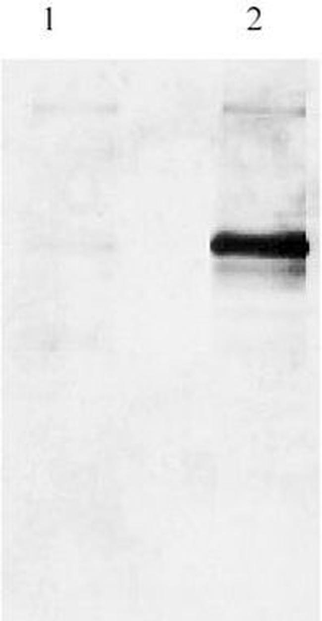 Phospho-PDE4A (Ser152) Antibody in Western Blot (WB)