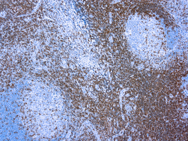 CD3e Antibody in Immunohistochemistry (Paraffin) (IHC (P))