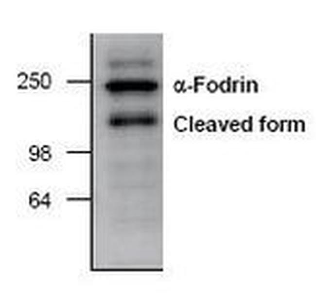 SPTAN1 Antibody in Western Blot (WB)