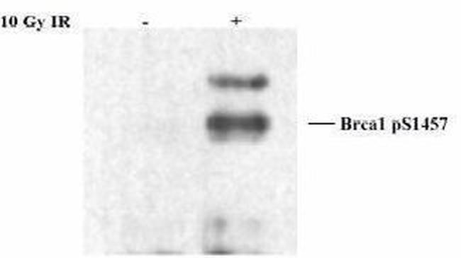 Phospho-BRCA1 (Ser1457) Antibody in Western Blot (WB)