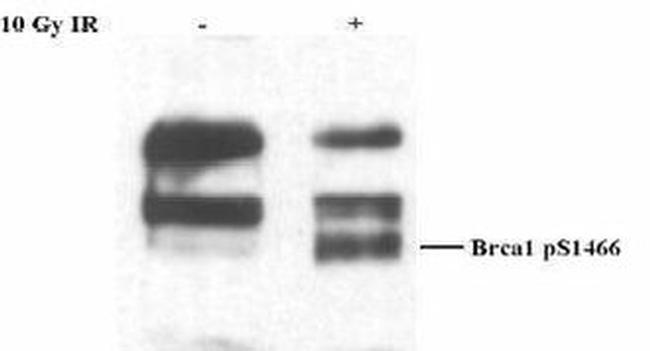 Phospho-BRCA1 (Ser1466) Antibody in Western Blot (WB)