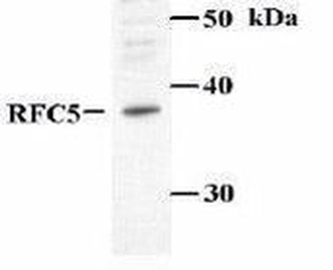 RFC5 Antibody in Western Blot (WB)