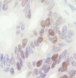MCM4 Antibody in Immunohistochemistry (Paraffin) (IHC (P))