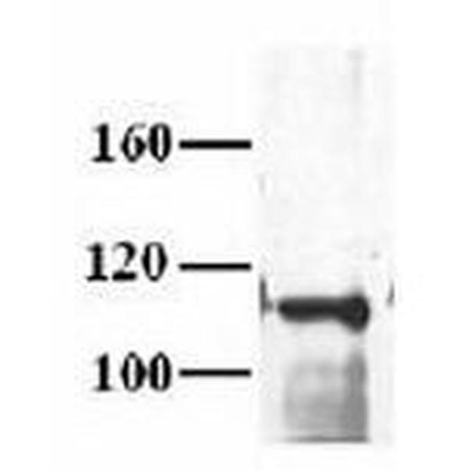 MCM10 Antibody in Western Blot (WB)