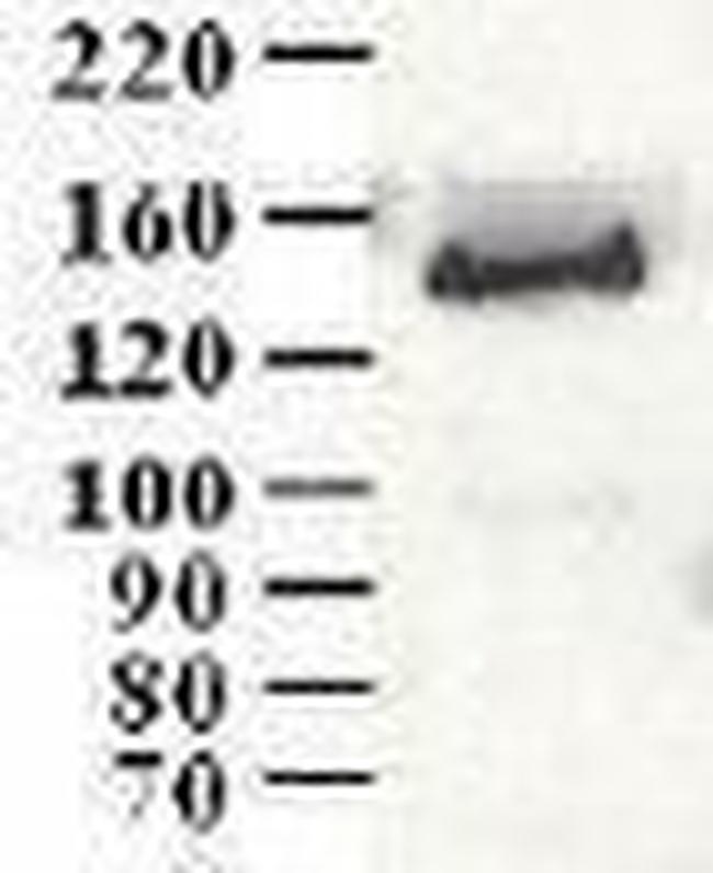 CCAR1 Antibody in Western Blot (WB)