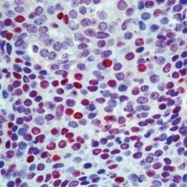 p57 Kip2 Antibody in Immunohistochemistry (IHC)