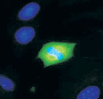 Phospho-MEK1/MEK2 (Ser221) Antibody in Immunohistochemistry (IHC)