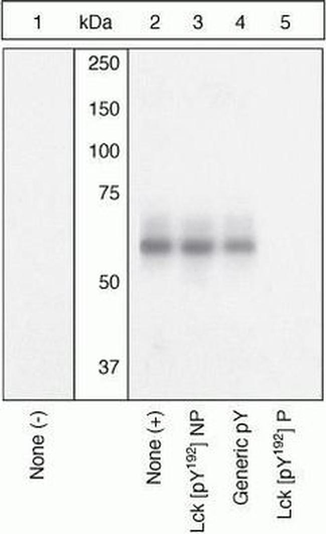 Phospho-LCK (Tyr192) Antibody in Western Blot (WB)