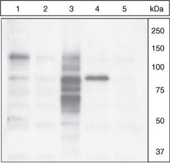 Phospho-Cortactin (Tyr421) Antibody in Western Blot (WB)