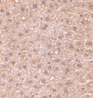 RYBP Antibody in Immunohistochemistry (IHC)